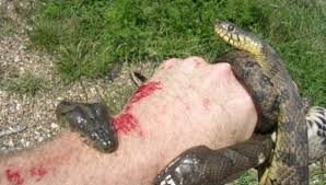 snake bite