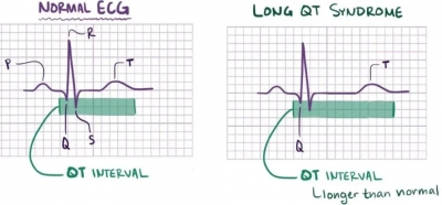 &Sigma;&Upsilon;&Nu;&Delta;&Rho;&Omicron;&Mu;&Omicron; &Mu;&Alpha;&Kappa;&Rho;&Omicron;&Upsilon; QT